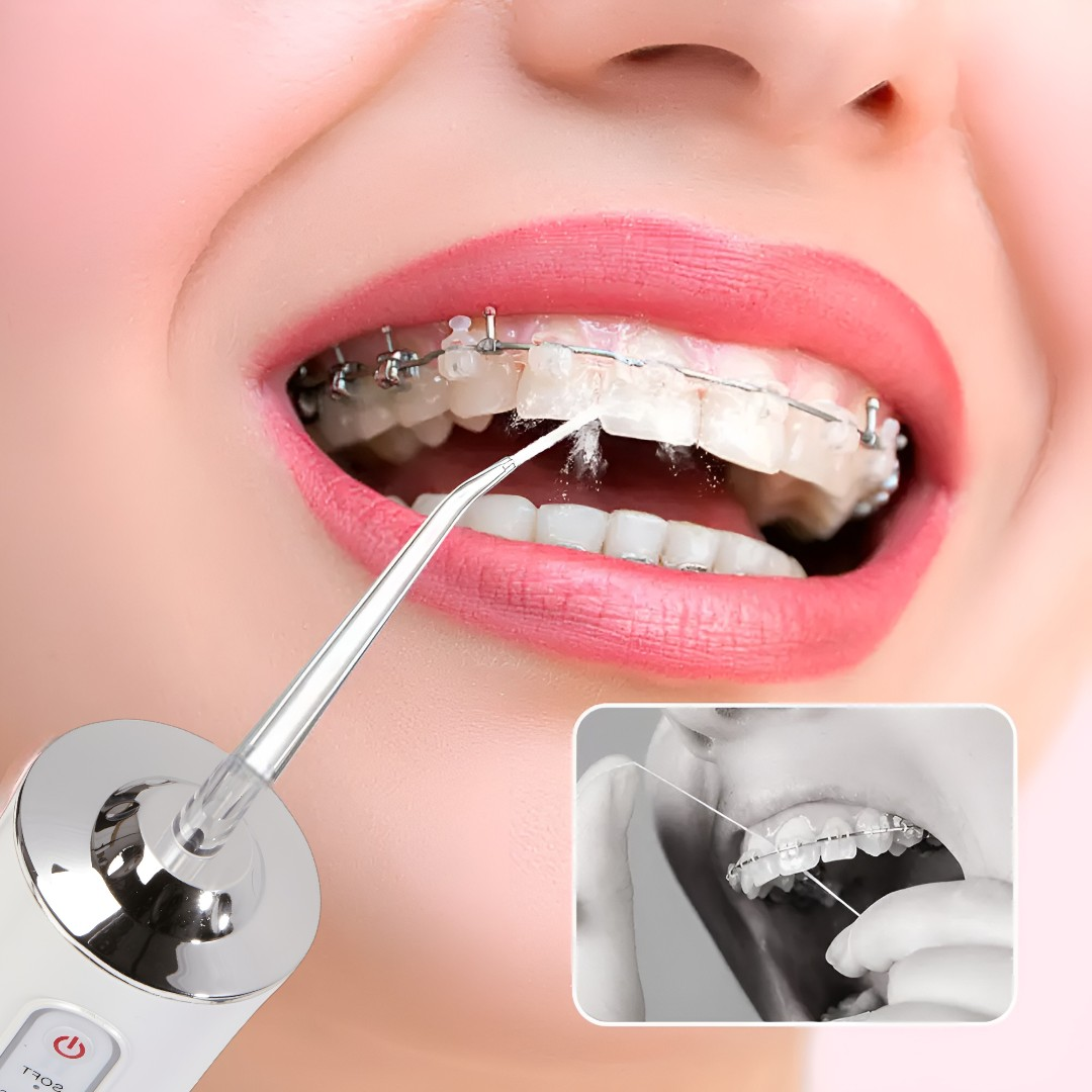 Irigator Oral Profesional pentru Dus Bucal - Curatare Dentara Avansata in 30 Secunde
